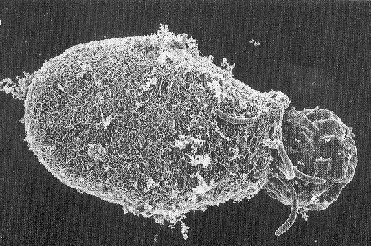 Giardia lamblia and Giardiasis With Particular Attention to the Sierra Nevada 4 June 2003 By Robert L. Rockwell Figure 1. Trophozoite Emerging from Cyst 1 Figure 2.