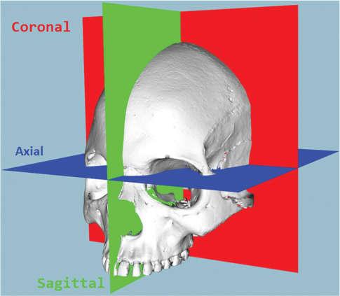 Slika 2. Perspektiva radiologa i neurologa [5] Model koordinatnog sustava anatomskog prostora ključan je u procesima obrade medicinskih slika.