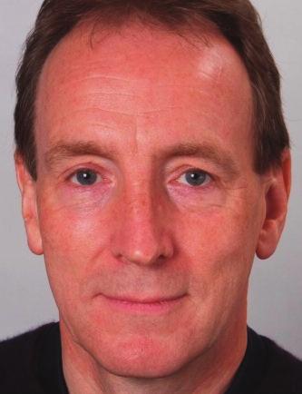Speaker Biographies Professor Paul O'Flynn FRCS Professor O'Flynn, is a Consultant ENT/Head and Neck Surgeon at London's University College Hospital.
