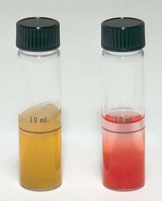 TOTAL COLIFORM TEST RESULTS POSITIVE TEST NEGATIVE TEST Gel rises to surface Many gas bubbles present Liquid below gel is cloudy Indicator turns yellow Liquid above gel is clear Indicator