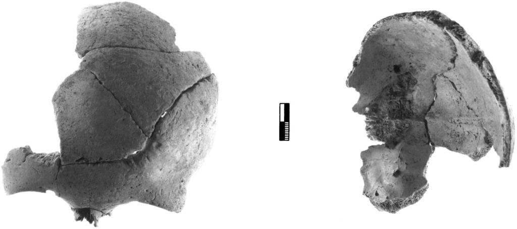 582 PHILIP P. BETANCOURT ET AL. right side of the frontal bone (see Fig. 19, left).