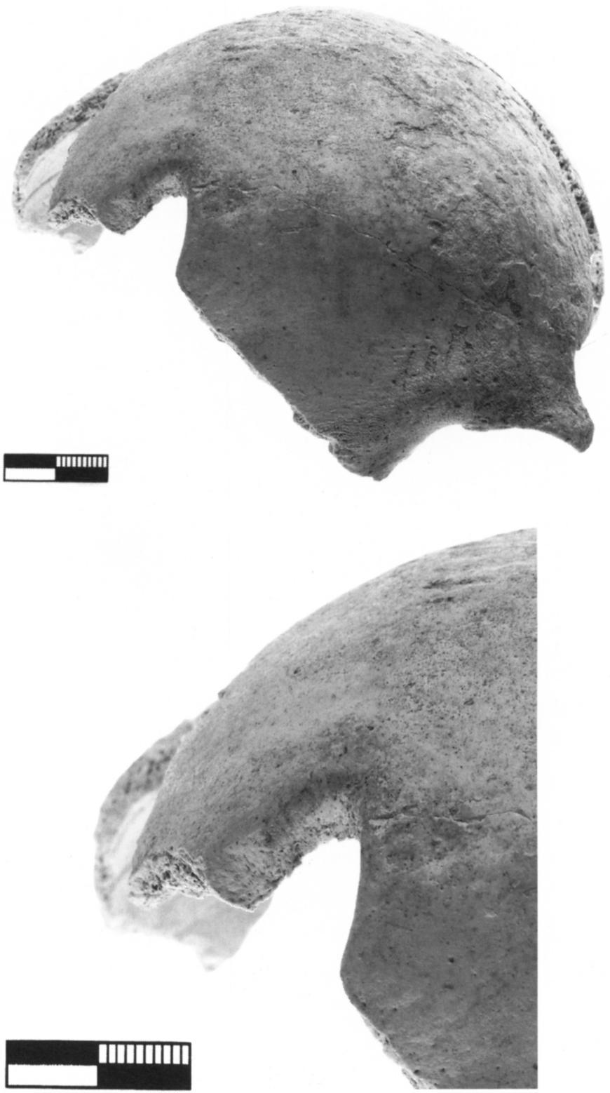 EXCAVATIONS IN THE HAGIOS CHARALAMBOS CAVE 585 Figure 26. Skull 8083. Frontal trephination. General view and detail. 122. See especially Hippoc, IJepi tcqv ev K <paxf\ rpcojudrcov.