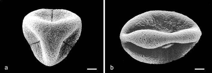 K. Sridith: Notes on Argostemm of the Mly Peninsul nd Peninsulr Thilnd 373 Plte 1.,. Eletron-mirogrphs of the pollen grin of A. unifolioides vr. glr. Sle r = 2 µm.