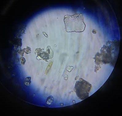 Fotografija 22: Diatomejska alga iz rodu Navicula sp.