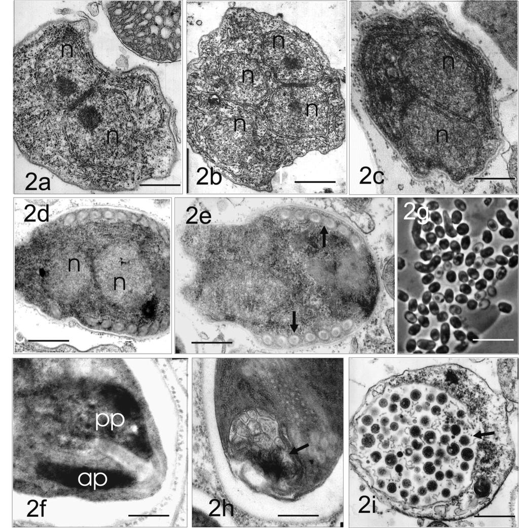 M.crosporidians 243 Fig. 2. Morphology and ultrastructure of microsporidium Nosema pontogaari.