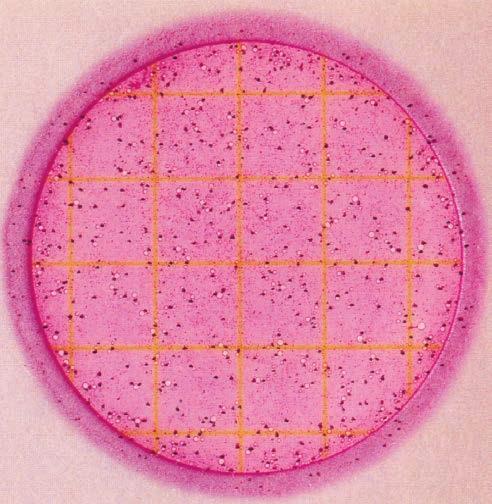 Estimates can be made on plates containing greater than 150 colonies by counting the number of colonies in one or more representative squares