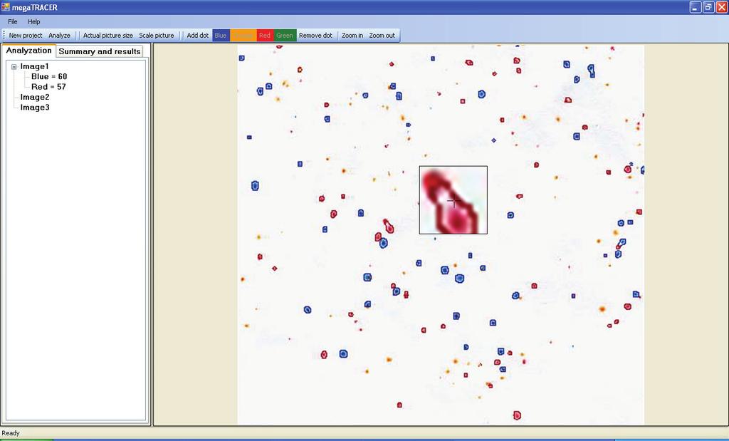 Slika 3. Izgled skenirane i analizirane slike filter papira sa zaokruženim česticama. Figure 3. Image of analyzed and scanned filter paper with rounded particles.