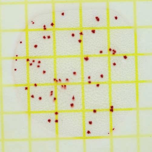 cfu Observation: Count all colonies regardless of their size or color