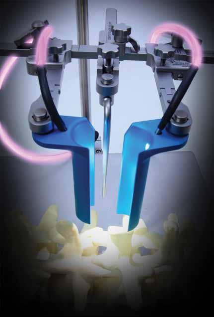 Spine Phantom Retractor System Overview Minimally invasive procedures Dual-directional