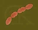 Najčešći uzročnici mastitisa su: bakterije (Streptococci S. uberis, S. dysgalactiae, S.