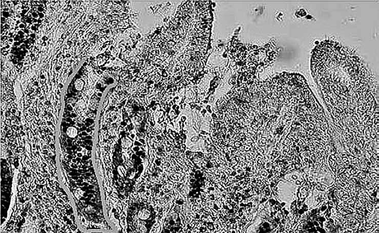 Poročilo o delu 2014 Primer histološkega preparata tankega črevesa (jejunum) barvanega s pomočjo protiteles proti PCNA za oceno nivoja proliferacije celic črevesnega epitela (pripravil OŽ) Ugotovili