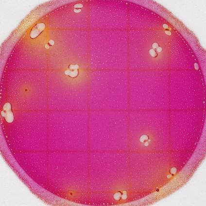coli colonies blue and Coliform colonies red, while the top film traps