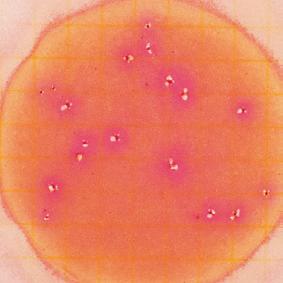 red colonies with yellow zones and gas bubbles. Select E.