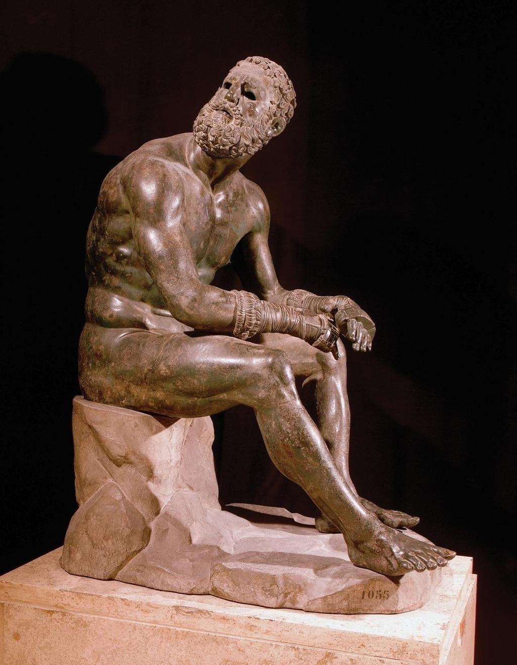 #41 Seated boxer. Hellenistic Greek. c. 100 BCE.