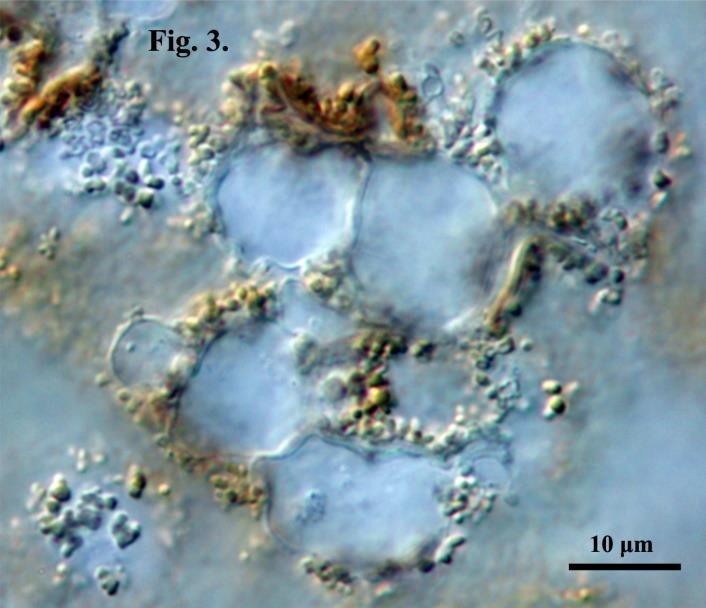 5 x 3-4 μm, ovoid, with smooth brownish wall and distinct germ pore (Fig. 10).