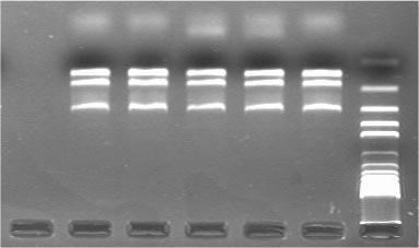 MULTIPLEX PCR DETECTION OF E. COLI O157:H7 1007 Fig. 1 Agarose gel electrophoresis of PCR ampli ed DNA from nontoxigenic Escherichia coli O157:H7 strain 3704 using H7, intimin and O157 PCR primers.