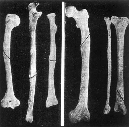 Zanimivo poznavanju poškodb, vendar Kahunov papirus kaže na to, da so zdravniki v Egiptu do neke mere obvladali le lažje kirurške posege, ki so jih očitno opravljali na živalih, saj za posege na