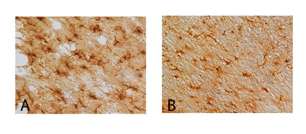 Slika 5. Imunohistohemijsko bojenje mozga pacova primenom GFAP monoklonskog antitela u kontroli (A) i 24 h nakon primene HPZ (B). Uvećanje x 400.