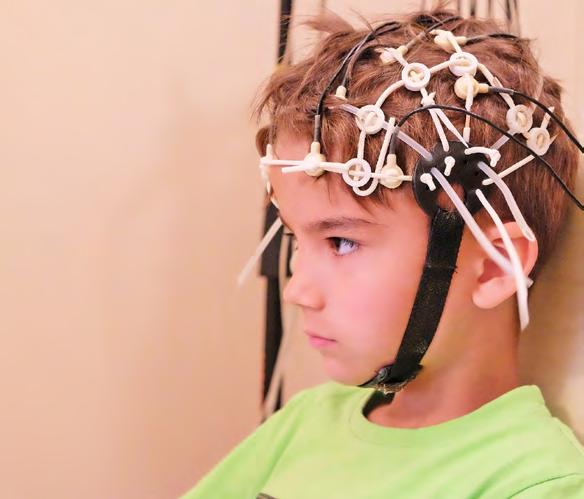 КАКО ДА ГО ПОДГОТВИТЕ ДЕТЕТО ЗА EEG СНИМАЊЕ Електроенцефалограм (EEG) е неинванзивно испитување кое од 20-тите години на минатиот век се користи рутински во дијагностиката на невролошки заболувања