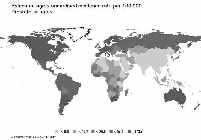 СТРУЧНИ И НАУЧНИ РАДОВИ Мапа 1. Стопе инцидеције* малигних тумора простате, 2008. година. *стопе стандардизоване према популацији света (на 100.