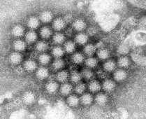 Norovirus in the Environment NV single stranded RNA virus CDC National Center for immunisation and respiratory disease Source human type, commonly cycles through shellfish,
