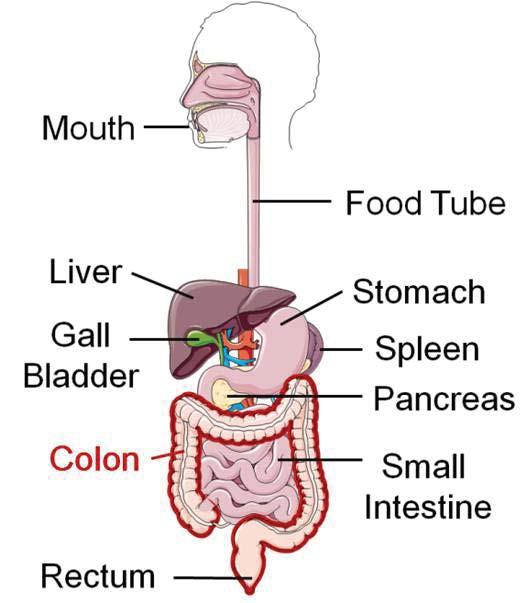 Most people survive colon cancer if it is caught early, and only 5% of people survive colon cancer if it is caught late.