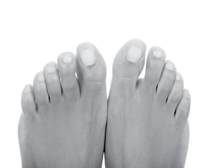 Do you have problems with your feet? Foot problems like calluses, bunions, corns, untrimmed toenails or ingrown toenails change the way you walk and can affect your balance.