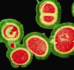 Staphylococcus aureus Може да се јави како етиолошки агенс на широка палета на болести, почнувајќи од помали кожни инфекции (фурункули, карбункули, пиодермии), до сериозни и животнозагрозувачки