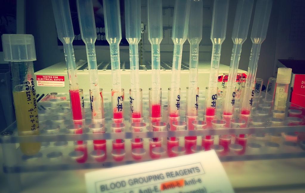 RESULTS Antigen testing was performed following package inserts for commercial antisera.