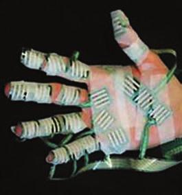 11% average increase in hand-surface contact area May reduce the potential for intraoperative hand fatigue May reduce the potential for temporary digital nerve compression Versatile for use in a