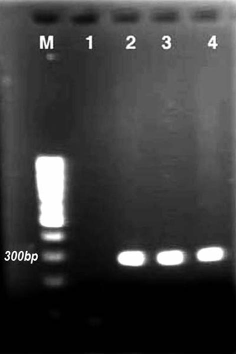Figure 1. PCR products of the samples for O157 gene (Column M: 100 bp DNA ladder, SM 0241, Fermentas Co.); Column 1: negative control, Column 2: positive control, Columns 3 and 4: positive samples).