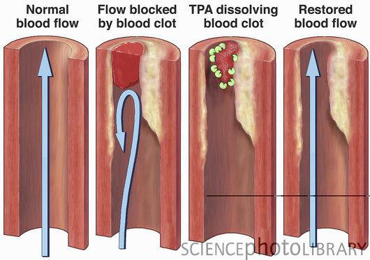 1. POLUMJER KRVNE ŽILE - kontrakcija ili relaksacija glatkih mišića stijenke krvne žile - tekućina bliže središtu krvne žile teče slobodnije zbog toga što se ne
