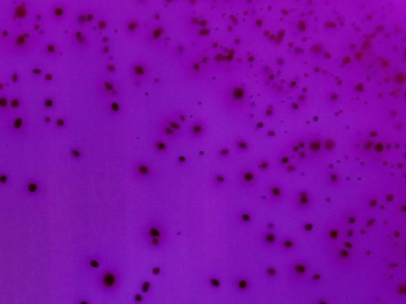 ljubičasto-ružičasto kolonije koliformnih bakterija