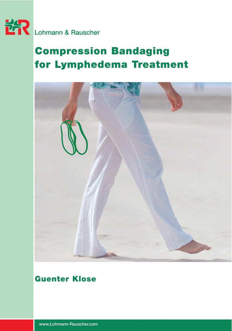 Compression Bandaging for Lymphedema Treatment by Guenter Klose Provides a complete overview of lymphedema, the role and function of