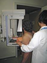 DORA ali rentgensko slikanje dojk vseh žensk med 50. in 69.