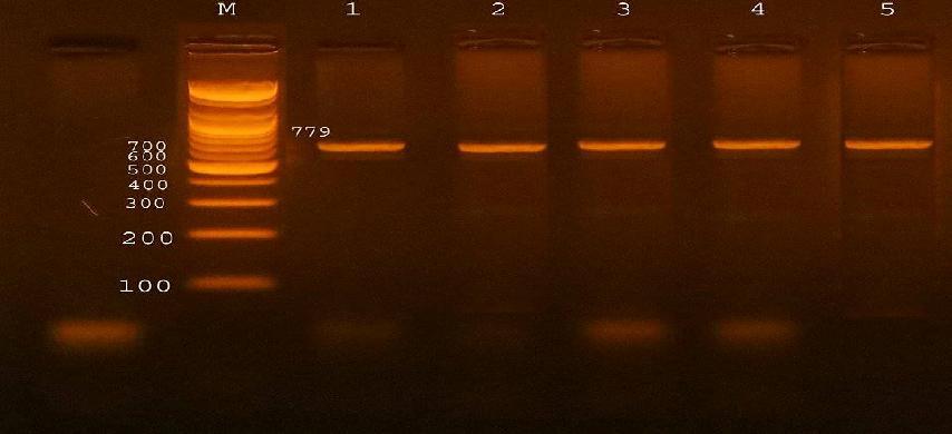 Figure 2: Agarose gel electrophoresis 2% showed amplification of 779 bp fragments of stx2 genes of E. coli O157:H7 Lane M shows PCR marker.