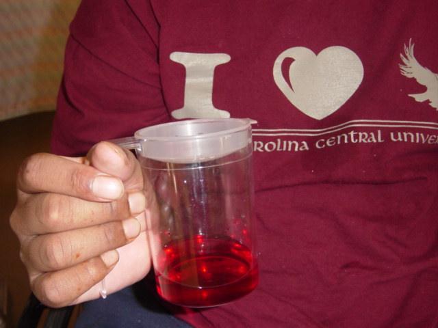 T-handle cup used with tenodesis
