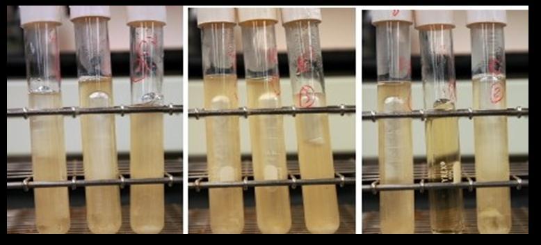 2.5 Përcaktimi i parametrave mikrobiologjikë Analizat e treguesve të ndotjes bakteriale janë kryer në laboratorin Mikrobiologjik të Departamentit të Biologjisë në FSHN, të Universitetit të Tiranës,