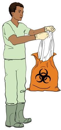 Step 5f: Remove the suit The assistant discards the coverall suit into infectious waste bag Step 5g: Perform Hand hygiene Alcohol-based handrub (20-30 sec) OR Soap