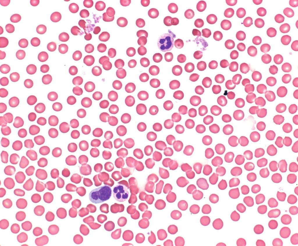 Hematology Reagents to identify diseases of the blood and blood forming organs The HARLECO product line offers ready to use staining solutions for blood and bone marrow samples that yield intense and