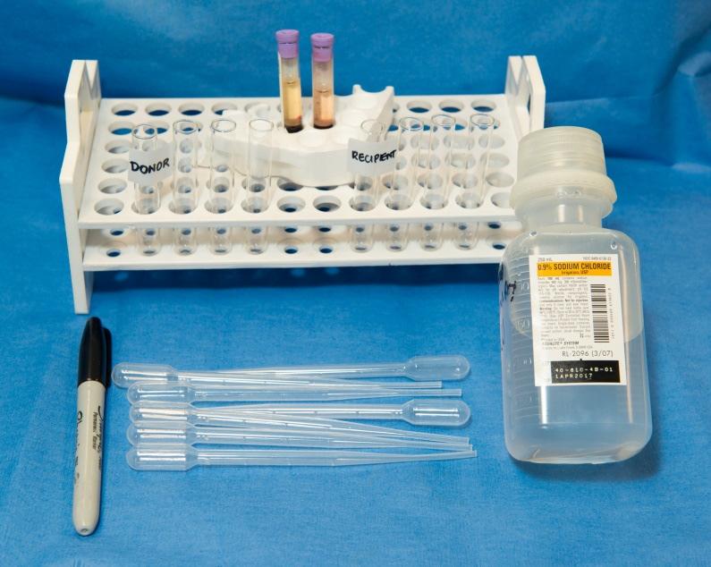 CROSS MATCHING STEP BY STEP Materials EDTA (preferred) or serum tube without separator