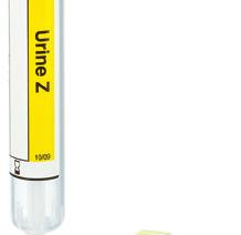 urine analysis can be placed directly into the fi lled