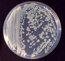 Coliform Genera Escherichia- human and animal feces Enterobacter-