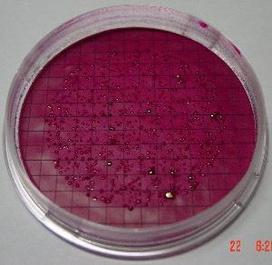 Membrane Filtration Total Coliforms (m-endo broth) Total Coliform Red colony wiih a metallic sheen