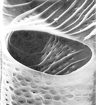 Za razliku od sekundarnih pora kod traheida golosemenica, ovde se na kontaktu dve ćelije pojavljuje otvor perforirana završna membrana. http://www.worldwoodday.org/activity/2013/e-card/, http://www.