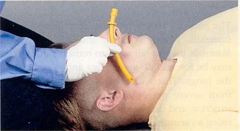 Nasopharyngeal Airways In contact with patient s s mucosal surfaces, maintain