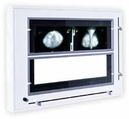 X-Ray Viewers High quality X-Ray film viewers are an essential piece of equipment in medical diagnosis.