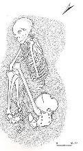 Fig.4. Skelet i zbuluar në Podgori, me karakter religjoz, i periudhës së neolitit të hershëm. Fig.5.