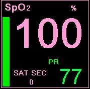 SpO2 podaci prikazani na Capnostream monitoru SpO 2 podaci prikazani na Capnostream monitoru Početni ekran Capnostream monitora prikazuje podatke SpO 2 u realnom vremenu.