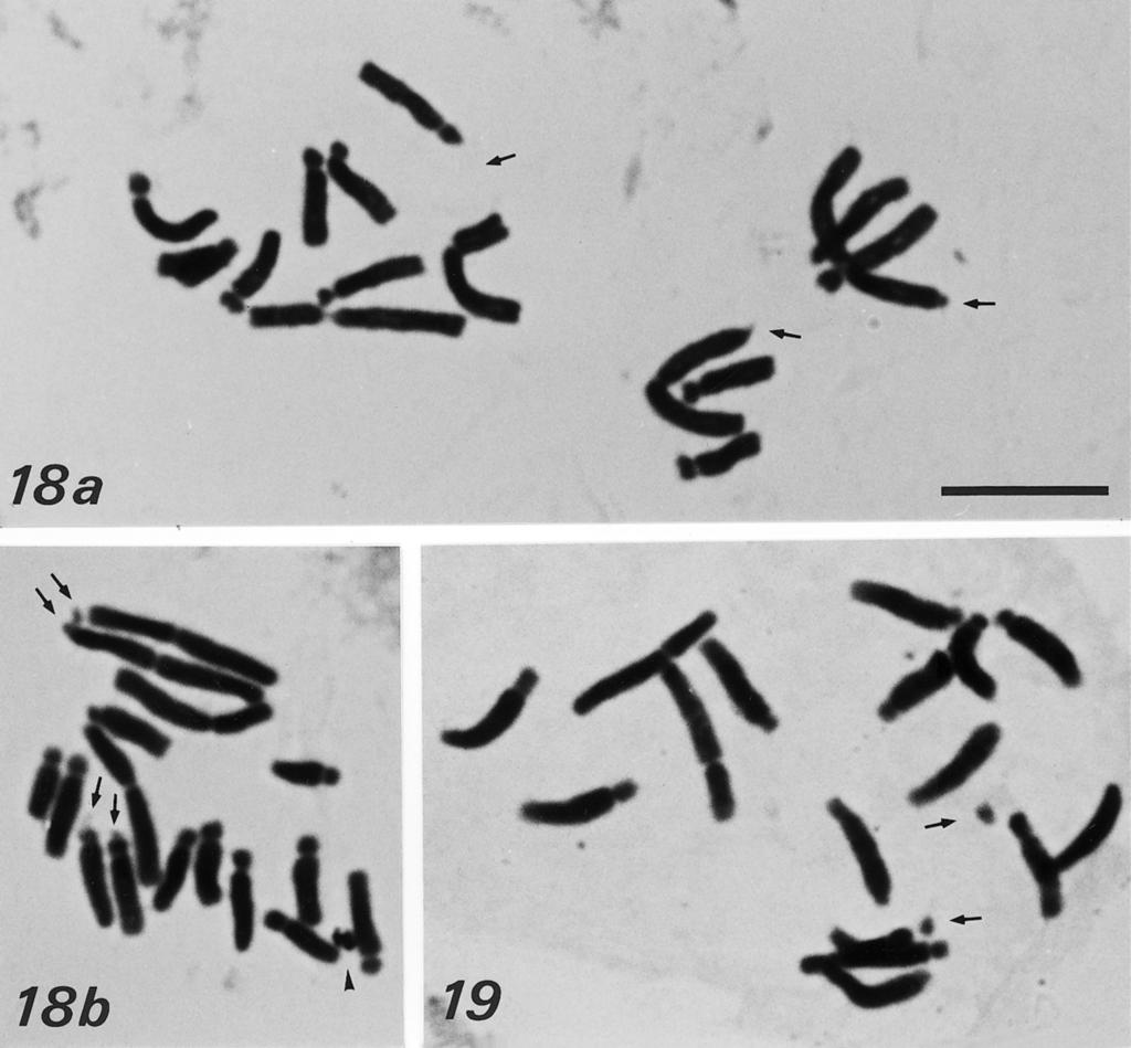 Willdenowia 27 1997 135 Figs 18 19. Mitotic metaphase plates 18: Delphinium fissum subsp. fissum, 2n = 16 (a) and 2n = 16 + 1B (b); 19: D. peregrinum, 2n = 16.